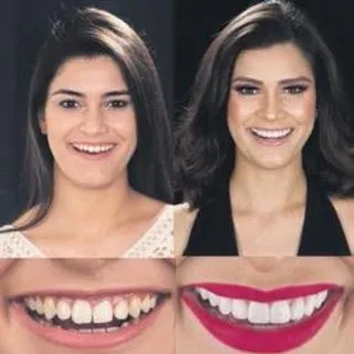 Her problemli diş ağrı yapmayabilir