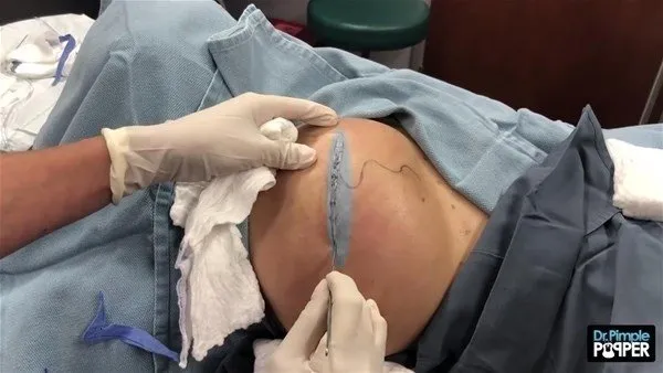 30 yıl boyunca baş ağrısı çekti! Sebebi kan dondurdu
