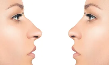 Burun estetiği yaşı 15’e düştü