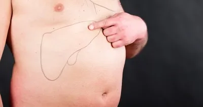 Mucize besin karaciğer yağlanmasını önlüyor! İşte karaciğer yağlanmasını önleyen reçete gibi öneri...