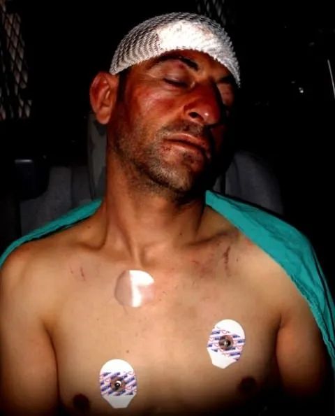Suriyeli çocuğun boğazını keserek öldürdü