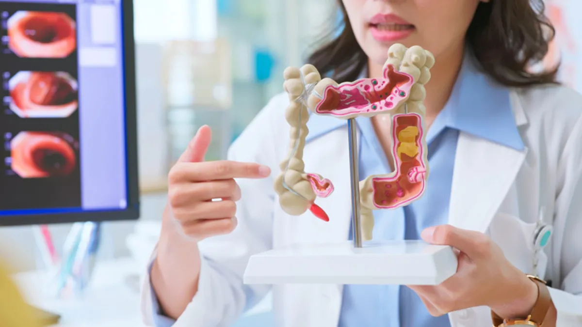 Uzmanlardan kritik uyarı! Kolon kanseri gençlerde hızla artıyor Uzmanlardan kritik uyarı! Kolon kanseri gençlerde hızla artıyor