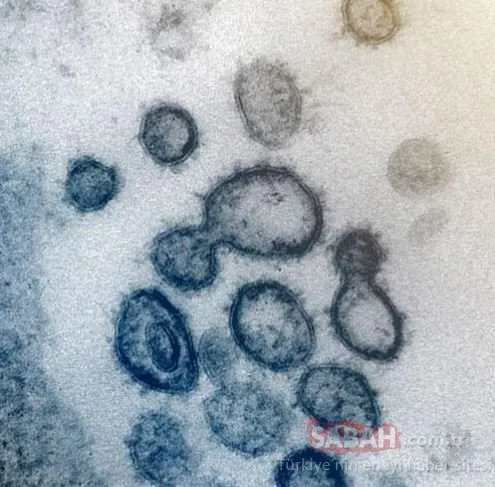 Son Dakika Haberi: ABD’li bilim insanları Coronavirüs’ü görüntüledi! Vücudu böyle etkisi altına alıyor...