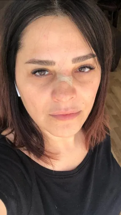 Ünlü şarkıcı Reyhan Karaca’nın talihsiz kazada burnu kırıldı!