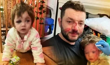 Yalova'da baba ve 14 aylık bebeğinin darbedildiği olayla ilgili müfettişler görevlendirildi #yalova