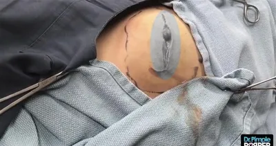 Şoke eden görüntüler! Genç kadının kalçasından...