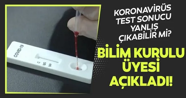 Son Dakika Corona Virusu Testi Sonucu Yanlis Cikabilir Mi Koronavirus Bilim Kurulu Uyesi Nden Dikkat Ceken Aciklama Son Dakika Haberler