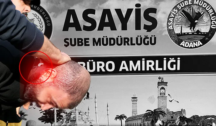 Adana’da kuyumcuyu omzundan ve sırtından vurarak altınları çalmıştı: O detay sayesinde yakalandı!