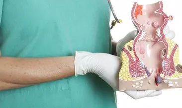 hemoroid nasil gecer hemoroid icin