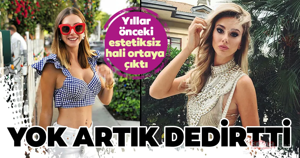 Şeyma Subaşı yıllar önceki haliyle yok artık dedirtti! İşte Şeyma Subaşı ve diğer ünlülerin estetiksiz halleri...