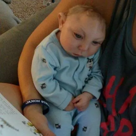 Mucize bebek 1 yaşında