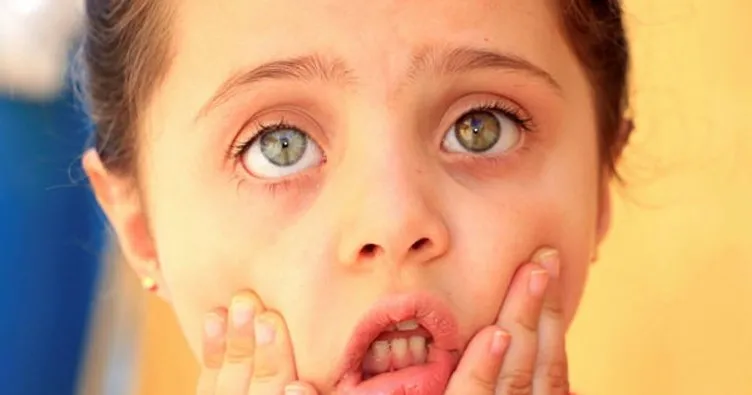 Gözleri farklı renkte olan çocuk görenlerin dikkatini çekiyor