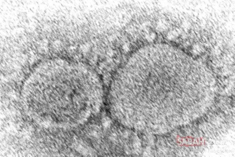 Omicron belirtileri nelerdir, nasıl anlaşılır? Koronavirüs Omicron Varyantı belirtilerine yenisi eklendi! Tırnaklarda…