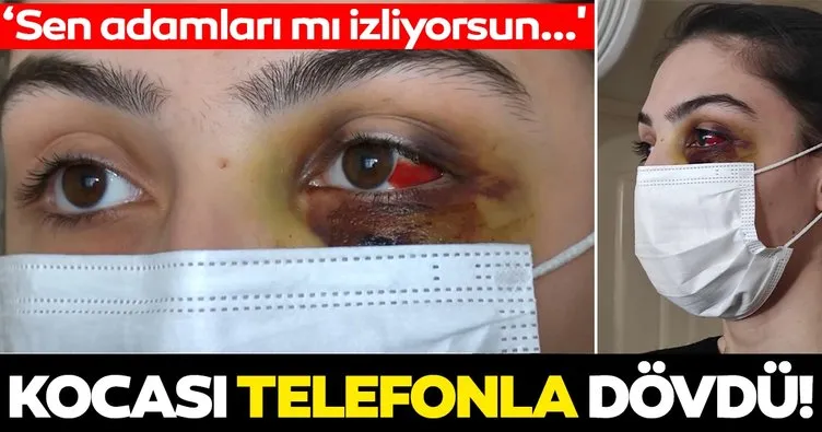 Son dakika haberi: İstanbul’da koca dehşeti! ’Sen adamları mı izliyorsun’ diyerek dövdü!