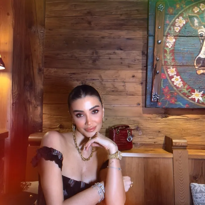 Sosyal medya ateş püskürdü! Manken Özge Ulusoy’dan ’filtre’ açıklaması! ’Kullanmıyorum diyen yalan söylüyor’