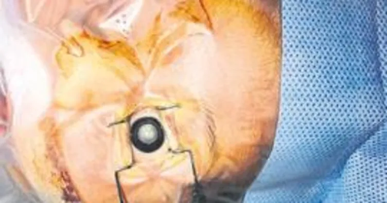 12 günlük bebeğe katarakt ameliyatı