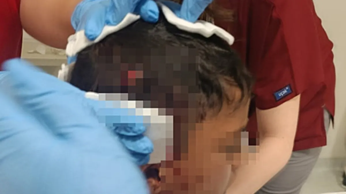 Ankara’da başıboş köpek dehşeti: 8 yaşındaki çocuk yaralandı! Ankara’da başıboş köpek dehşeti: 8 yaşındaki çocuk yaralandı!