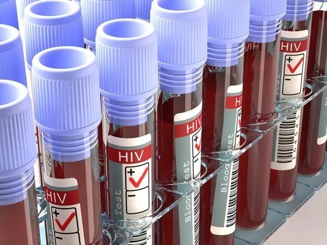 AIDS’ten korunmanın yolları!