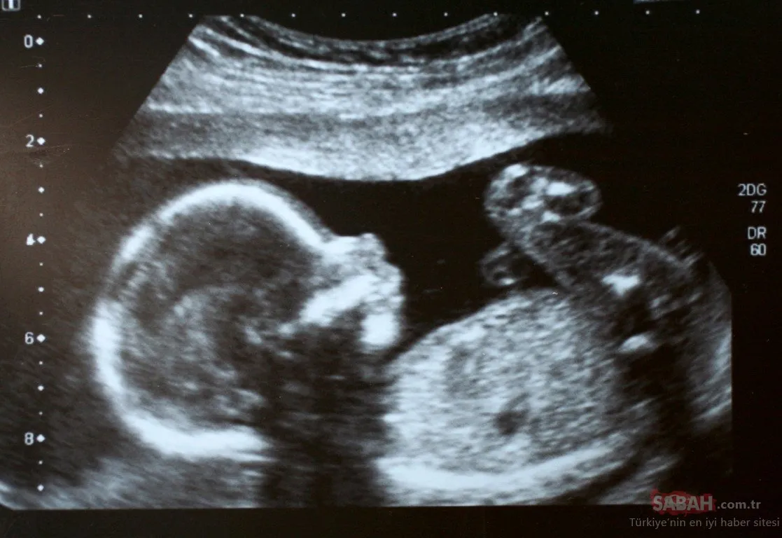 anne adaylari dikkat tarama testleri gebelikte buyuk onem tasiyor galeri bebegim ve biz