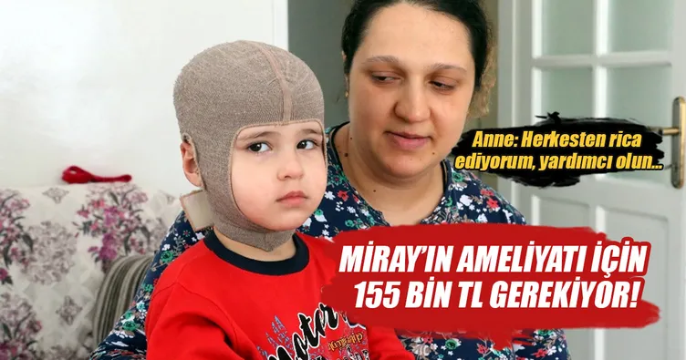 Miray için 155 bin TL gerekiyor