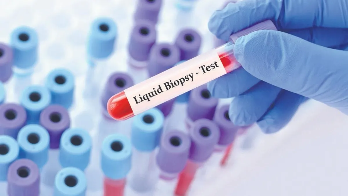 Kanserde likit biyopsi dönemi – Sağlık Haberleri Kanserde likit biyopsi dönemi – Sağlık Haberleri