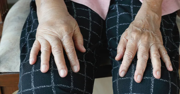 Anjioödem bir anda sizde görülebilir mi?