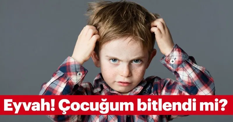 Eyvah Cocugum Bitlendi Mi Bitten Nasil Kurtulunur Cocuk Haberleri