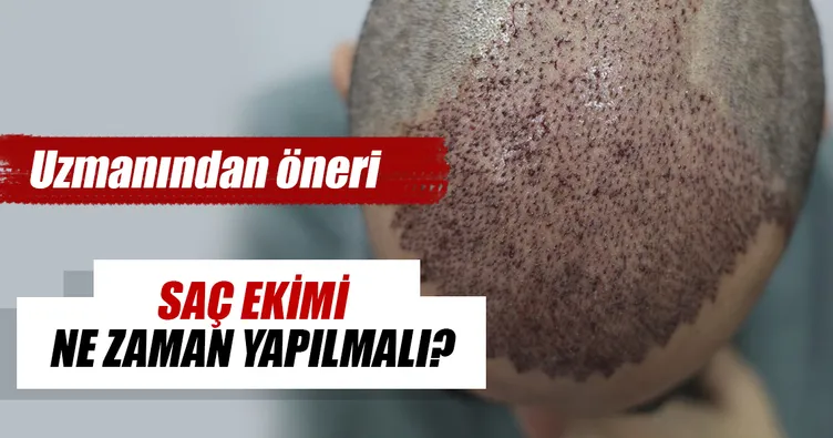 Saç ekimi ne zaman yapılmalı?