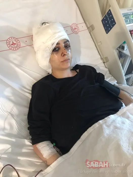 Son dakika haberi: Sultangazi'de talihsiz kadına tayt dayağı: Gözünü hastanede açtı