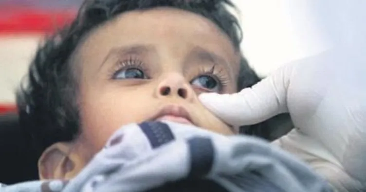 Yemen’de 859 kişi koleradan öldü