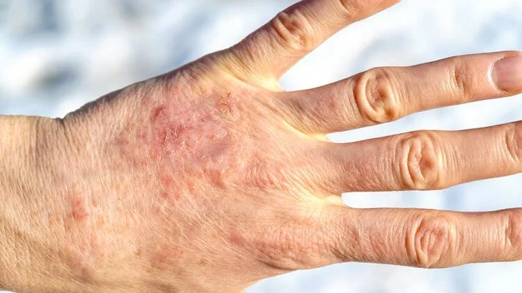 Egzamasi Olanlar Ellerinizi Yikarken Bunlara Dikkat Sayfa 9