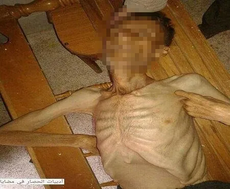 Suriye’nin Medaya kasabasında 40 bin kişi açlıktan ölüyor
