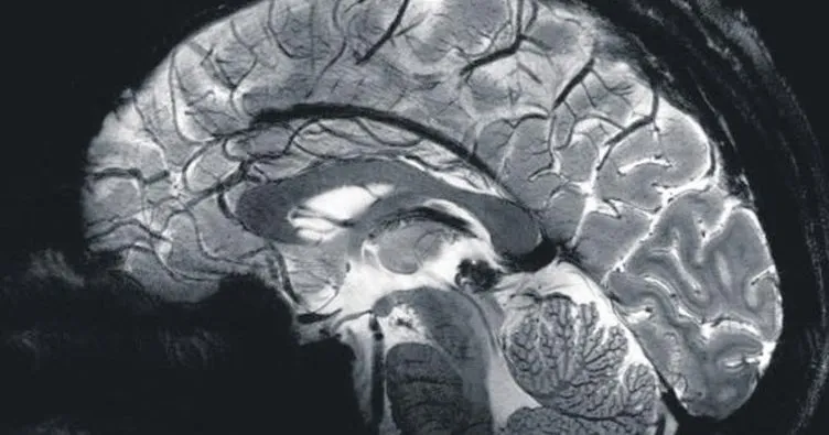 İnsan beyninin en detaylı hali ilk kez görüntülendi