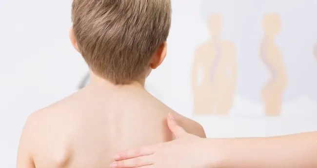 Cocuklarda Kamburlugu Onlemenin 5 Altin Kurali Son Dakika Haberler