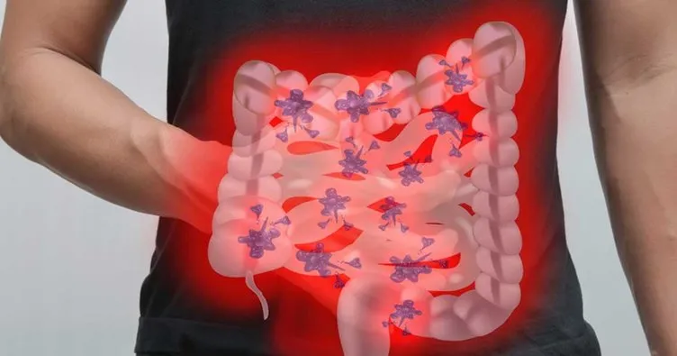Yaygın enfeksiyonlar mide ve bağırsakları nasıl etkiledi?