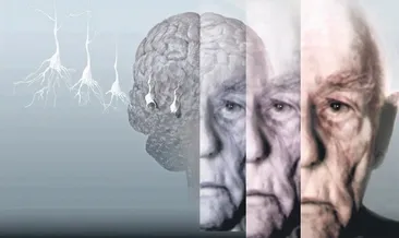 Korkulu rüyamız Alzheimer
