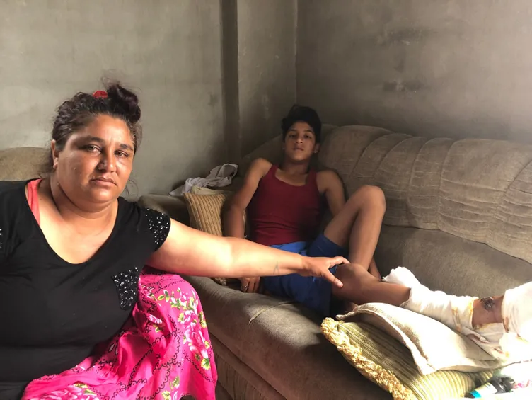 Pitbull 13 yaşındaki çocuğa saldırdı! Bıraksalar beni yiyecekti