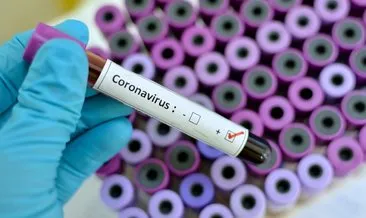 Corona virüs pandemisine karşı plazma tedavisi işe yarıyor