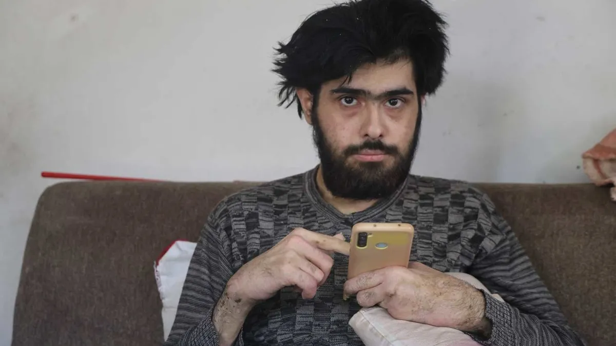 SON DAKİKA… Tüm Türkiye onu konuşmuştu! Telefon bağımlısı Barış Özbay’dan üzen haber geldi: Tedaviyi reddetti haber görseli
