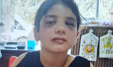 Bakanlıktan darp edilen otizmli çocuğa destek #aksaray