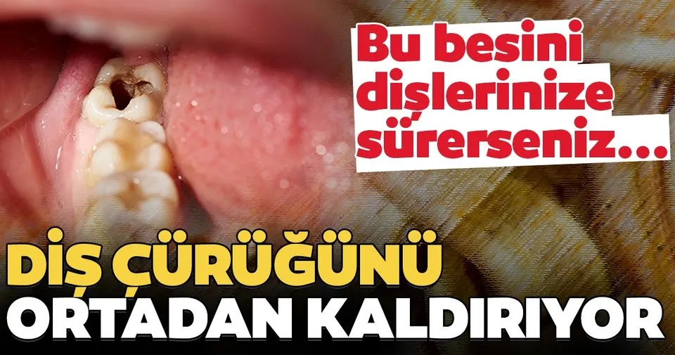 Curuk Dis Problemini Ortadan Kaldiriyor Son Dakika Haberler