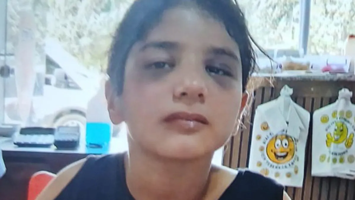Bakanlıktan darp edilen otizmli çocuğa destek Bakanlıktan darp edilen otizmli çocuğa destek