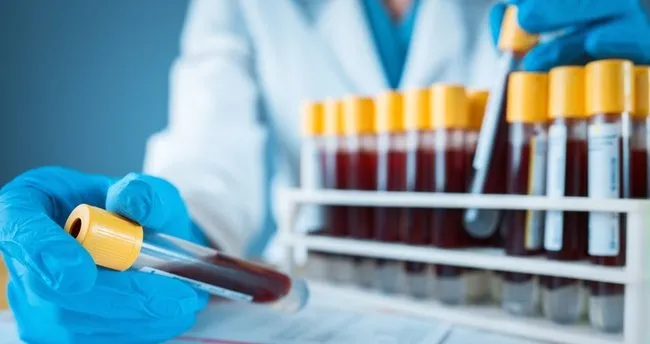 T.C. Kimlik No ile Tahlil Sonucu Öğrenme 2022 - MHRS E-Devlet ve E-Nabız ile Tahlil Sonuçları Nasıl Öğrenilir?