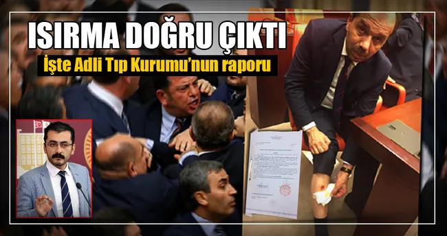 Adli Tıp’ın ’ısırık raporu’ ortaya çıktı!