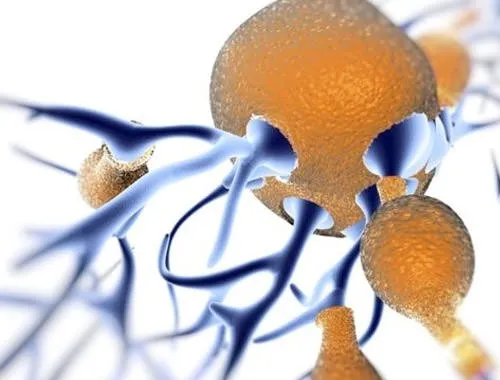 Araştırmadan çıkan çarpıcı sonuçlar: Alzheimer’ı önlüyor!