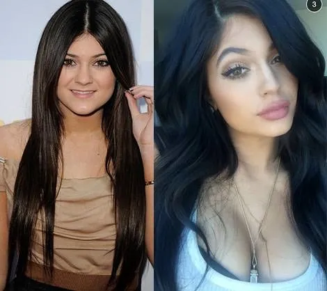 Ünlülerin estetiksiz hali 2017 - Galeri - Magazin