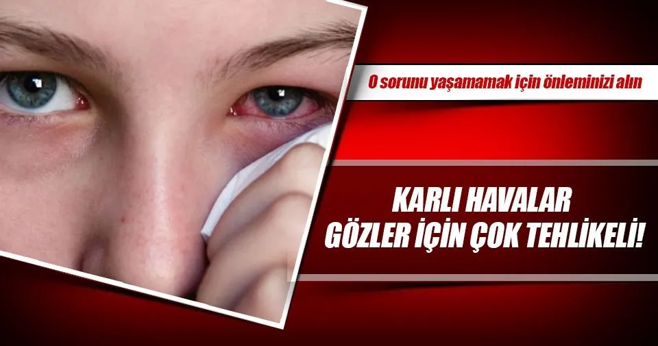 Karli Havalar Gozler Icin Cok Tehlikeli Sayfa 4 Saglik Haberleri