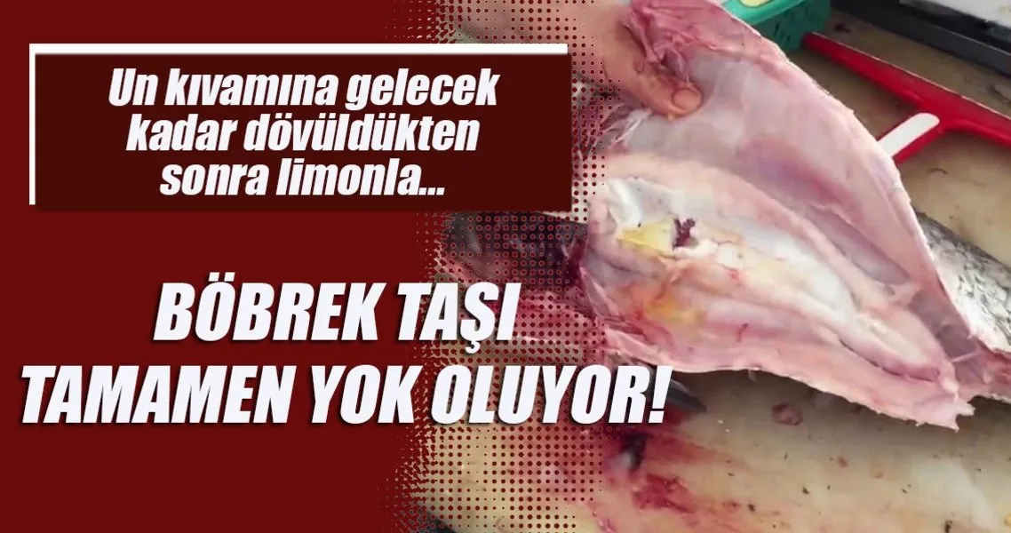 bobrek tasi tamamen yok oluyor saglik haberleri