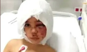 SON DAKİKA: Prof.Dr. Özlenen Özkan’dan Asiye Ateş’in sağlık durumu ile ilgili yeni açıklama: Yüz felci riski var, Asiye şu an şokta...
