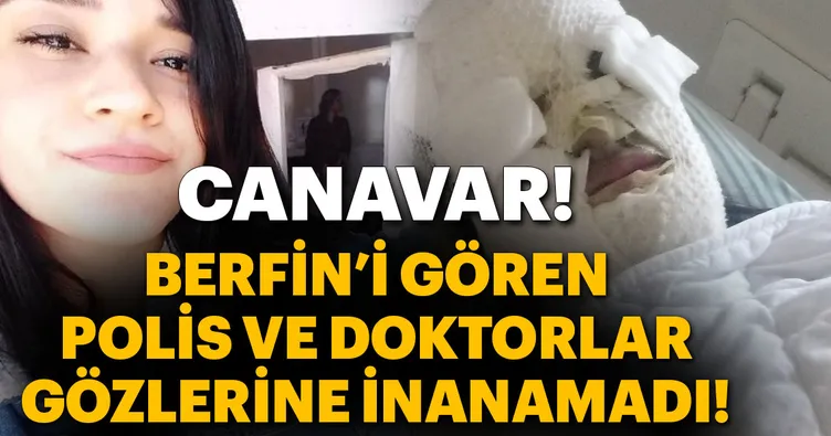 Platonik aşık, Berfin’i bu hale getirdi